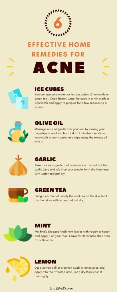 Effective Home Remedies for Acne