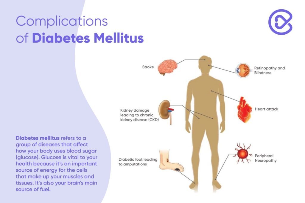 Complications of Diabetes mellitus