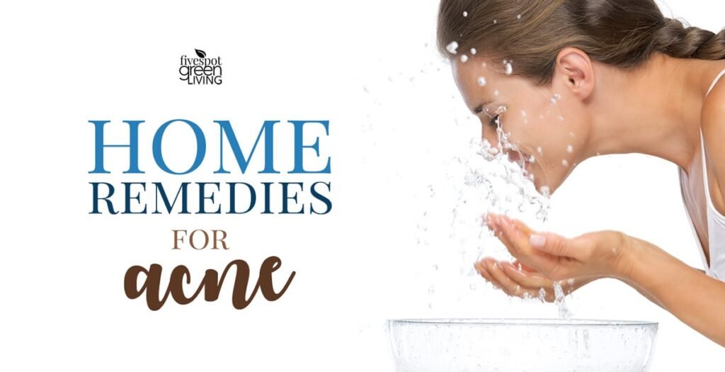 Home remedies for acne