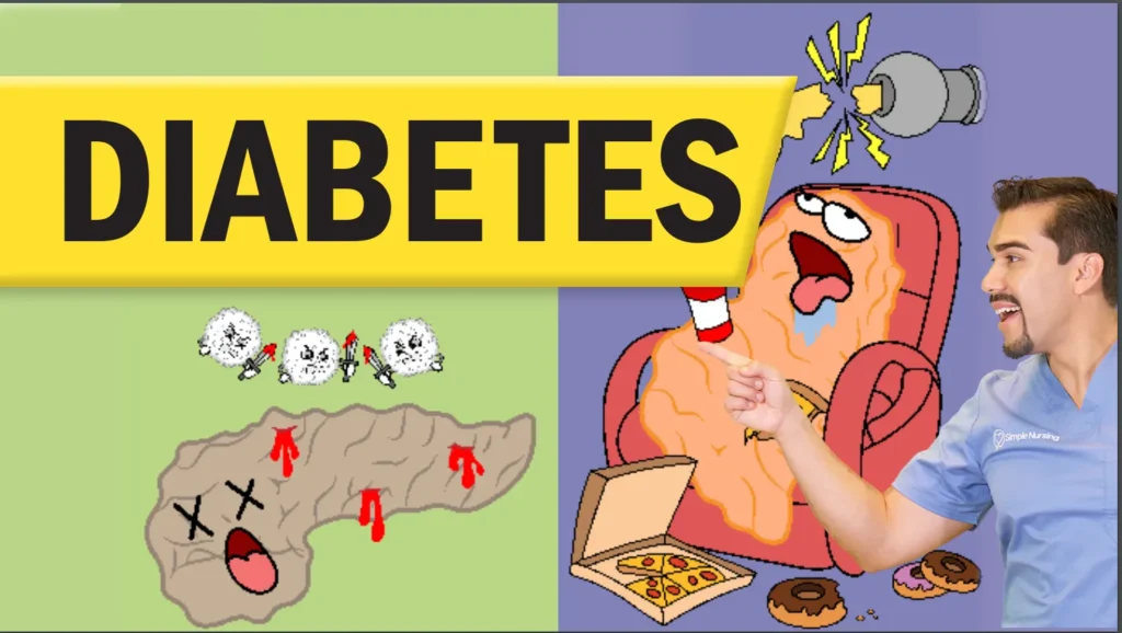 Type 2 Diabetes mellitus