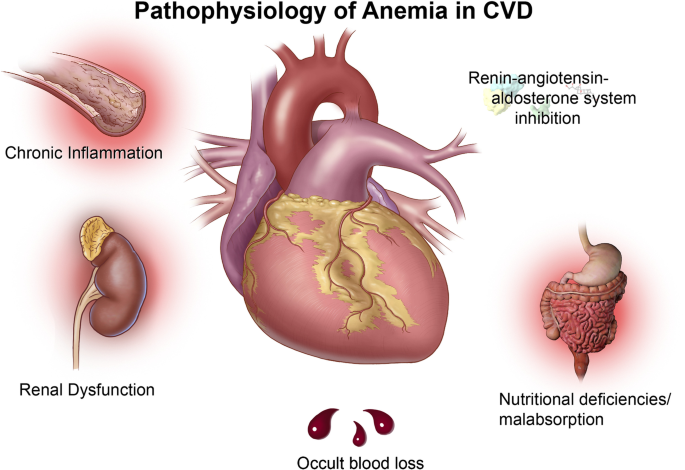 pathophysiology of amenia