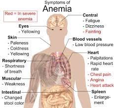 symptoms of heart muscle anemia