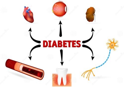 Following Diabetes Mellitus Guidelines for Better Health