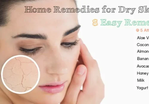 7 Soothing Home Remedies for Acne